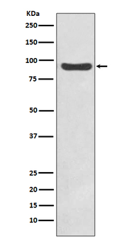 IKK beta Recombinant Rabbit Monoclonal Antibody