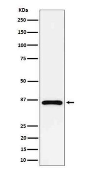 GAS2 Recombinant Rabbit Monoclonal Antibody