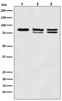 IKK alpha/beta Recombinant Rabbit Monoclonal Antibody