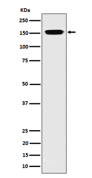 NUP155 Recombinant Rabbit Monoclonal Antibody