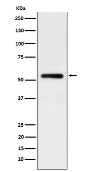 Human IgG1 Recombinant Rabbit Monoclonal Antibody