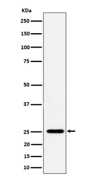 Factor D Recombinant Rabbit Monoclonal Antibody