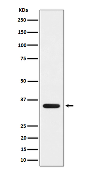 DEGS1 Recombinant Rabbit Monoclonal Antibody