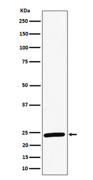 RAB8A Recombinant Rabbit Monoclonal Antibody