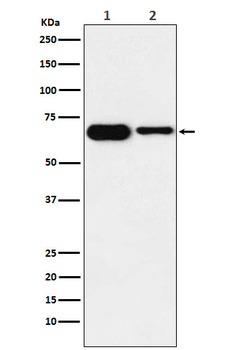 IGF2BP2 Recombinant Rabbit Monoclonal Antibody