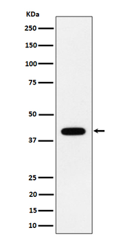 ACADS Recombinant Rabbit Monoclonal Antibody