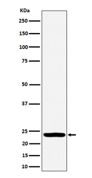 DTYMK Recombinant Rabbit Monoclonal Antibody