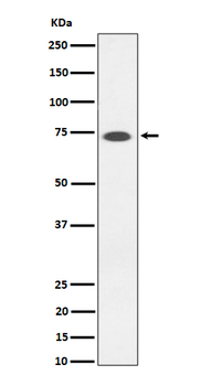 SSTR3 Recombinant Rabbit Monoclonal Antibody