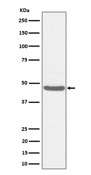 BCKDH kinase Recombinant Rabbit Monoclonal Antibody