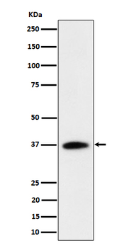 RASSF2 Recombinant Rabbit Monoclonal Antibody