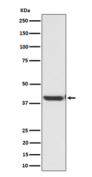 ENDOGL1 Recombinant Rabbit Monoclonal Antibody
