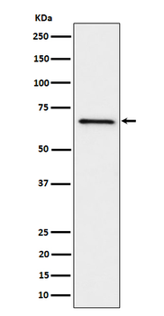 GRK6 Recombinant Rabbit Monoclonal Antibody