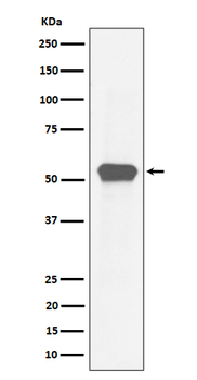 MEF2A Recombinant Rabbit Monoclonal Antibody
