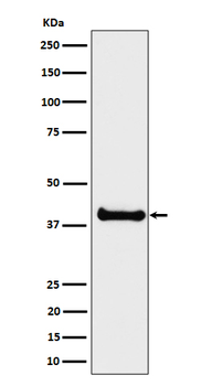 ALS2CR1 Recombinant Rabbit Monoclonal Antibody