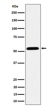 ENPP5 Recombinant Rabbit Monoclonal Antibody