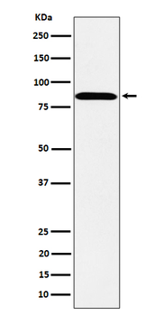 PPM1E Recombinant Rabbit Monoclonal Antibody