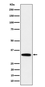 PPP6C Recombinant Rabbit Monoclonal Antibody