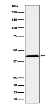 NCR2 Recombinant Rabbit Monoclonal Antibody
