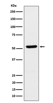 ZNF259/ZPR1 Recombinant Rabbit Monoclonal Antibody