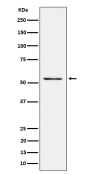 SLC45A3 Recombinant Rabbit Monoclonal Antibody