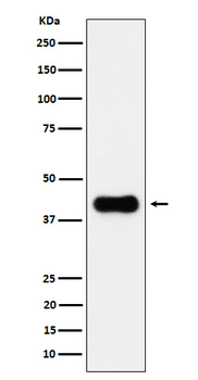 ACAA2 Recombinant Rabbit Monoclonal Antibody