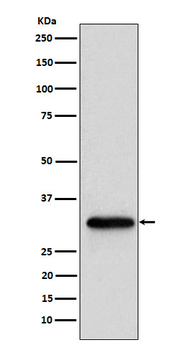 NUDT5 Recombinant Rabbit Monoclonal Antibody