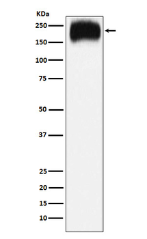 NPC1 Recombinant Rabbit Monoclonal Antibody