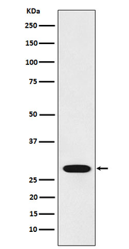 RCHY1 Recombinant Rabbit Monoclonal Antibody