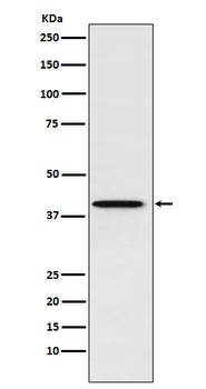PCBP1 Recombinant Rabbit Monoclonal Antibody
