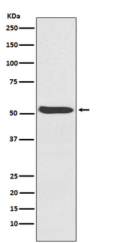 Activin receptor type-1 Recombinant Rabbit Monoclonal Antibody