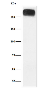 MGLUR3 Recombinant Rabbit Monoclonal Antibody