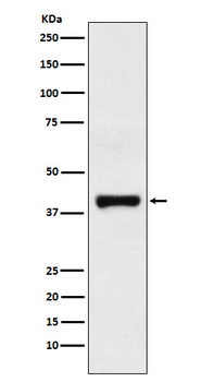 GOT2 Recombinant Rabbit Monoclonal Antibody