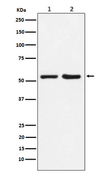 P4HB Recombinant Rabbit Monoclonal Antibody
