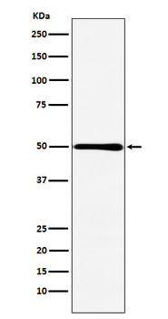 HMGCS2 Recombinant Rabbit Monoclonal Antibody