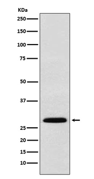 KGF Recombinant Rabbit Monoclonal Antibody