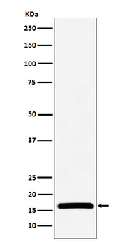 Nm23-H2/NME2 Recombinant Rabbit Monoclonal Antibody