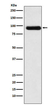 ACVR2A Recombinant Rabbit Monoclonal Antibody