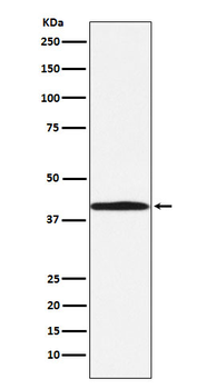 ABO Recombinant Rabbit Monoclonal Antibody