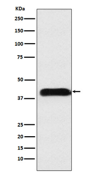 M6PR Recombinant Rabbit Monoclonal Antibody