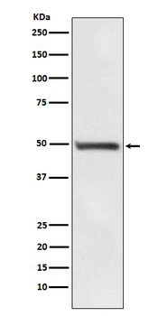 RAD52 Recombinant Rabbit Monoclonal Antibody