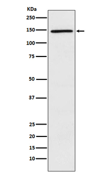 PLCG 2 Recombinant Rabbit Monoclonal Antibody