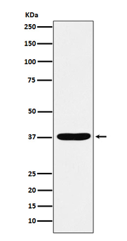 AKR1C1/2 Recombinant Rabbit Monoclonal Antibody