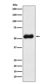 Thromboxane synthase Recombinant Rabbit Monoclonal Antibody