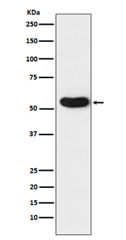 CHRNA5 Recombinant Rabbit Monoclonal Antibody