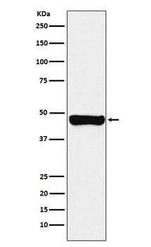 RCC1 Recombinant Rabbit Monoclonal Antibody