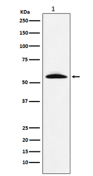 GGT1 Recombinant Rabbit Monoclonal Antibody