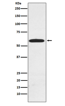 RAD23A Recombinant Rabbit Monoclonal Antibody