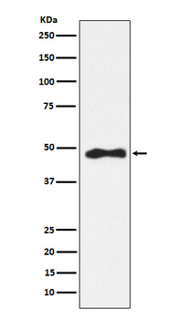 AP2 alpha Recombinant Rabbit Monoclonal Antibody