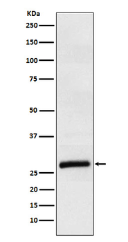 ApoM Recombinant Rabbit Monoclonal Antibody