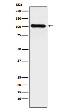 BRIP1/BACH1 Recombinant Rabbit Monoclonal Antibody